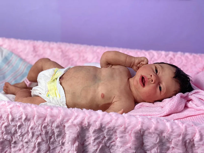 Bebê Reborn de Silicone  sólido -  Charlote