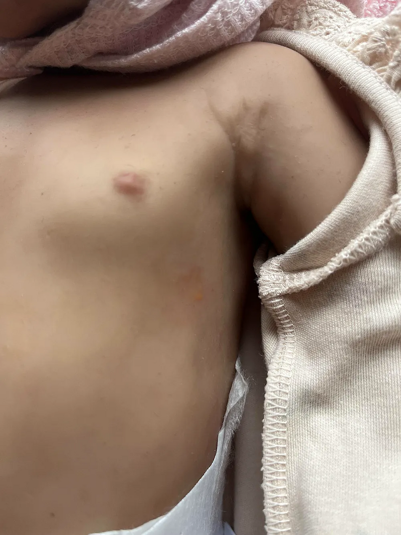 Bebê Reborn de Silicone  sólido - Cloe
